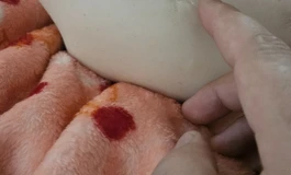 粉猫儿硅胶植发口腔带通道