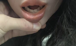 82年的烂手机拍的实拍图，大家可以看看硅胶可口带植发的