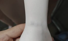 只有这一个108微瑕体了
