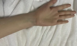 164松骨架开箱