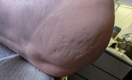 出人造人科技r22单身体