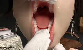 开口佳米口腔