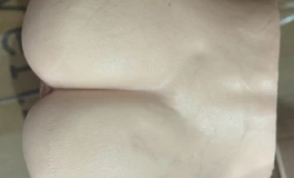 臀模