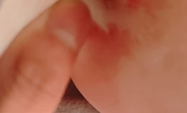 下体开裂咋办，可能是带套子，套有点糙了，才用了几次润滑我涂的不少的