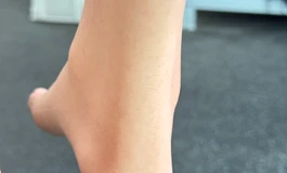 全新现货148皮纹