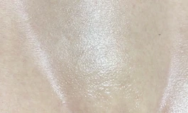 感觉手机拍的皮纹偏红
