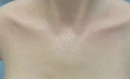 出个卿之友铂金硅胶半身899
