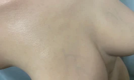 出个卿之友铂金硅胶半身899