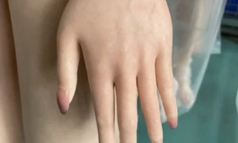 出厂硅胶瑕疵身体