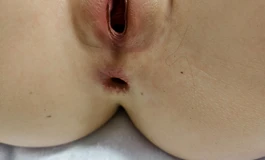 阿加鲁155 无大瑕疵 通道有内部损  2k6包邮 【已出封贴】