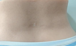 出全新彼之良硅胶腿模