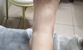 2500包邮出奈也s38腿模带脚趾骨